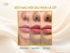 So sánh môi nhợt nhạt và môi sau khi kích màu môi sau phun