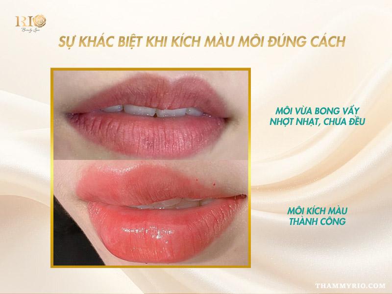 Bí quyết kích màu môi sau phun: Đảm bảo lên màu chuẩn đẹp 3 Đôi môi sau khi được kích màu thành công, màu sắc tươi tắn, căng mọng
