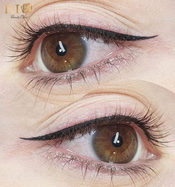 Phun mí Eyeliner giúp đôi mắt sắc nét, cuốn hút tự nhiên 2 Mắt phun mí eyeliner sắc nét, đường mí rõ ràng giúp đôi mắt to tròn, cuốn hút.