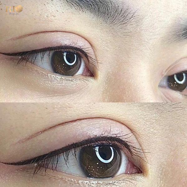 Phun mí Eyeliner giúp đôi mắt sắc nét, cuốn hút tự nhiên 6 Kết quả phun mí eyeliner công nghệ mới, không sưng đau, lên màu chuẩn.