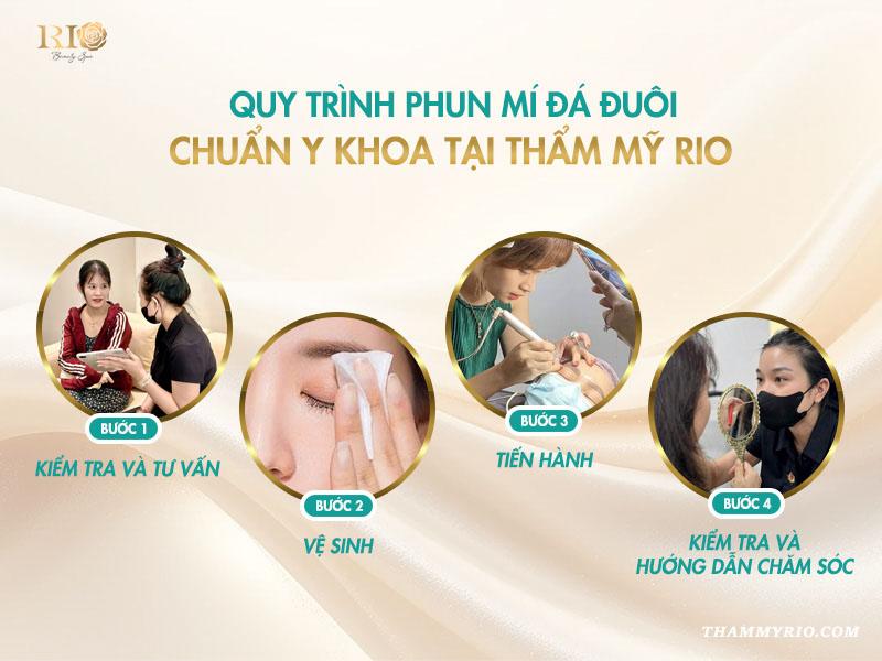 Phun mí mở tròng đá đuôi - Xu hướng cho đôi mắt cuốn hút 2026 6 Quy trình phun mí mở tròng đá đuôi chuẩn y khoa tại Thẩm Mỹ Rio,