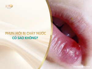 Lý do xăm môi bị chảy nước vàng
