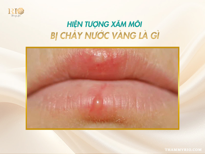 Phun môi bị chảy nước có sao Không? Cách xử lý nước mô sau xăm 2 Hiện tượng xăm môi bị chảy nước vàng là gì, giải thích về huyết tương