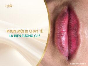 Phun môi bị cháy tê là hiện tượng gì