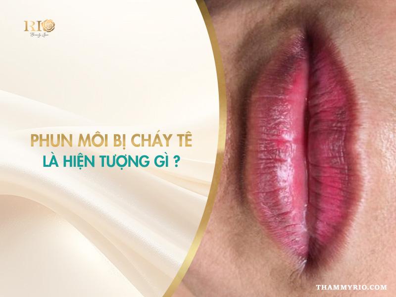 Phun môi bị cháy tê là do đâu? Cách khắc phục an toàn 2 Phun môi bị cháy tê là hiện tượng gì