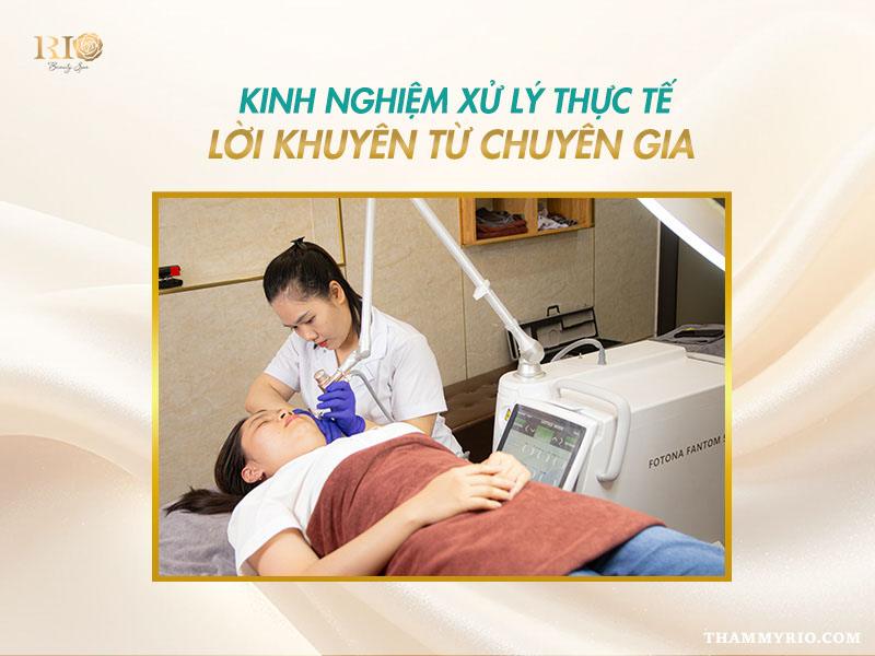 Phun môi bị cháy tê là do đâu? Cách khắc phục an toàn 6 Chuyên gia Phạm Thanh Tâm – chuyên gia phun xăm thẩm mỹ mày, mí, môi