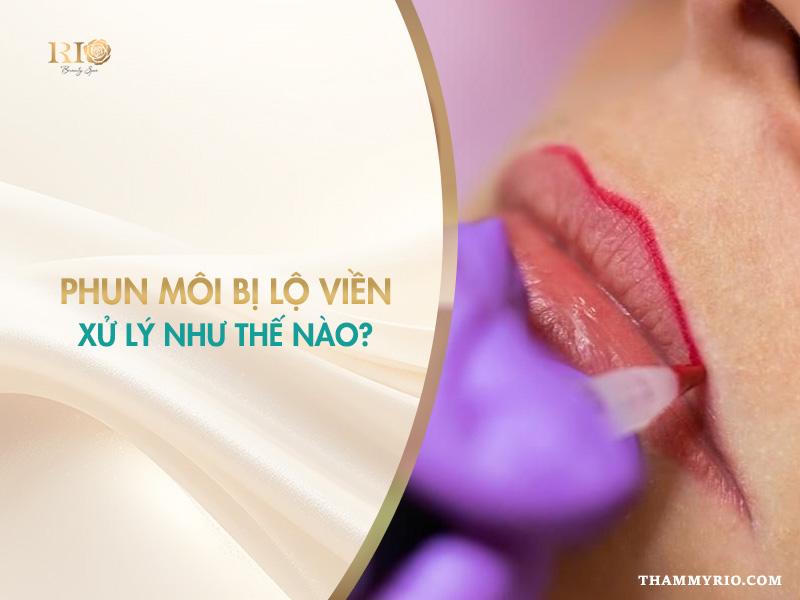Phun môi bị lộ viền môi xử lý thế nào chuẩn, ít tốn kém? 1 phun môi bị lộ viền