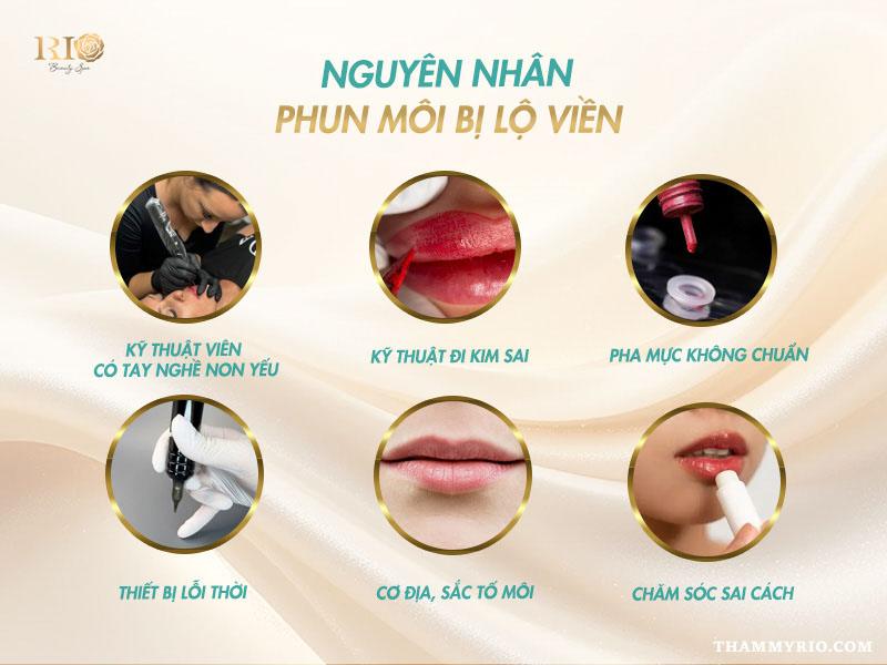 Phun môi bị lộ viền môi xử lý thế nào chuẩn, ít tốn kém? 3 Nguyên nhân phun môi bị lộ viền