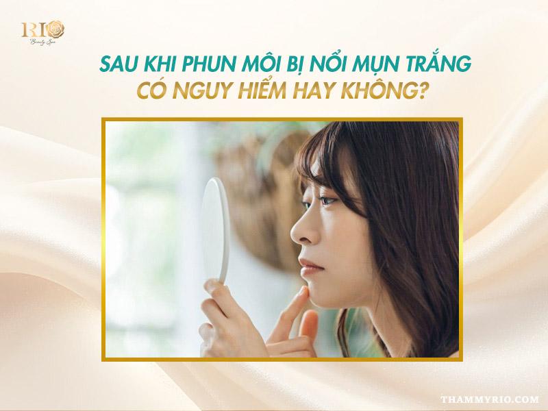 Sau khi phun môi bị nổi mụn trắng là do đâu? Cách xử lý 3 Sau khi phun môi bị nổi mụn trắng có nguy hiểm không