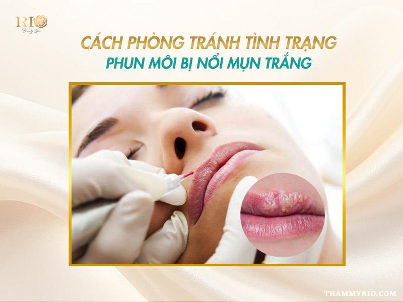 Sau khi phun môi bị nổi mụn trắng là do đâu? Cách xử lý 5 Cách phòng tránh phun môi bị nổi mụn trắng