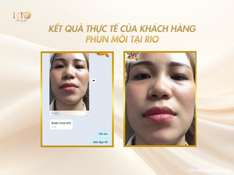 Phun môi màu nào đẹp cho tuổi 50 để làn da sáng bật tone? 9 Khách hàng tuổi 50 trước và sau phun môi với màu hồng đào