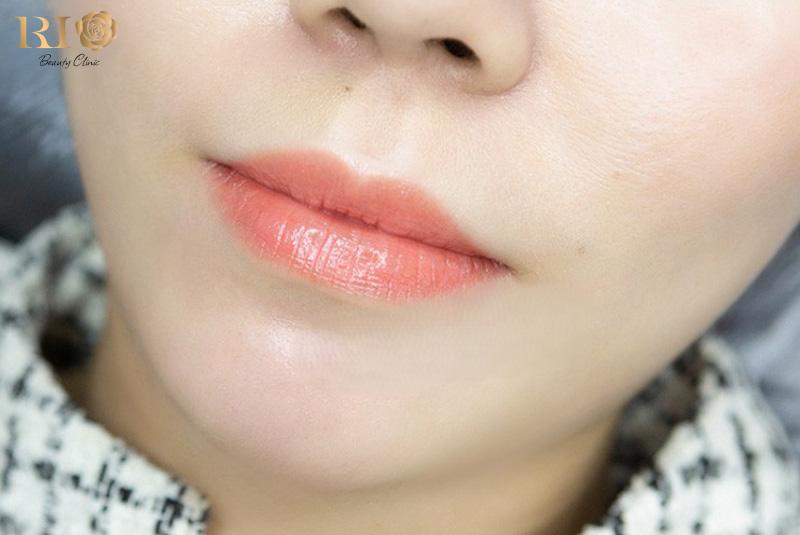 Phun môi màu cam san hô giá bao nhiêu? Đối tượng nên phun 8 Cam san hô là lựa chọn hoàn hảo giữa sự tươi sáng và tự nhiên, phù hợp với nhiều tone da Á Đông.