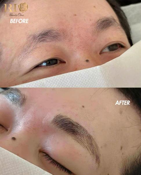 Before-after điêu khắc lông mày nam Hairstroke 9D cho khách VIP 40 tuổi tại Rio