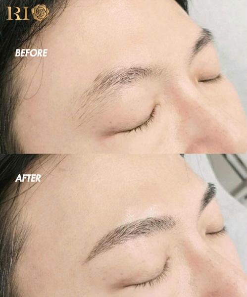 Before-after điêu khắc mày nam phong thuỷ tại Rio