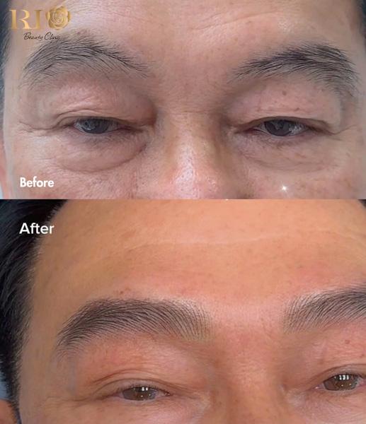 Before-after xăm lông mày nam Hairstroke