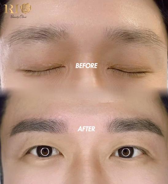 Before-after dáng mày phong thủy mệnh Mộc cho doanh nhân tại Rio