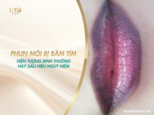 Phun môi bị bầm tím - hiện tượng bình thường hay dấu hiệu nguy hiểm