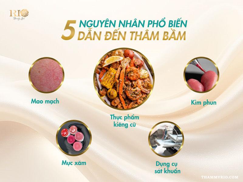 Xăm môi bị bầm tím có sao không? Cách xử lý hiệu quả tại nhà 3 Xăm môi bị bầm tím có sao không? Nguyên nhân phun môi bị bầm tím
