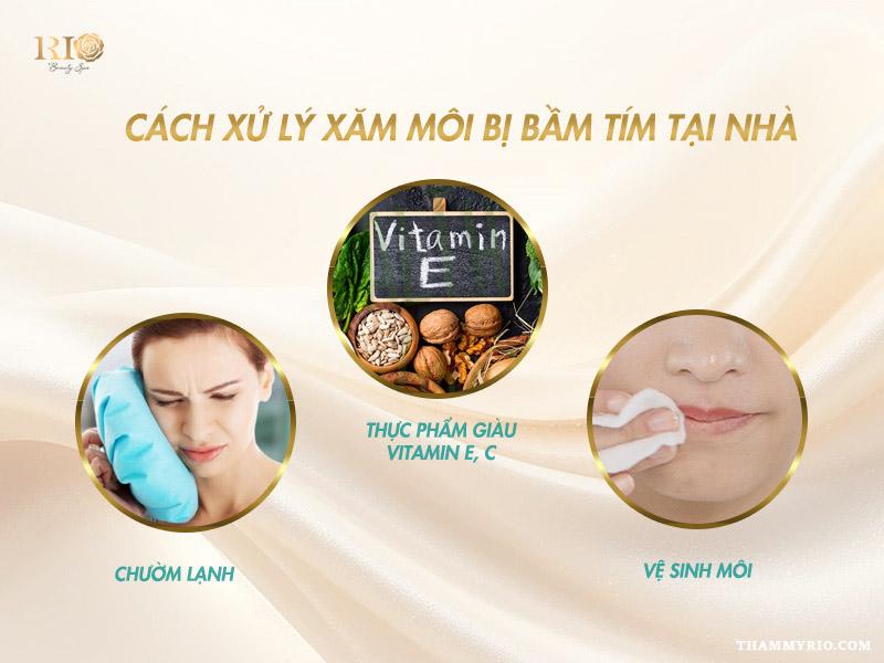 Xăm môi bị bầm tím có sao không? Cách xử lý hiệu quả tại nhà 4 Xăm môi bị bầm tím có sao không? Cách xử lý phun môi bị bầm tím tại nhà