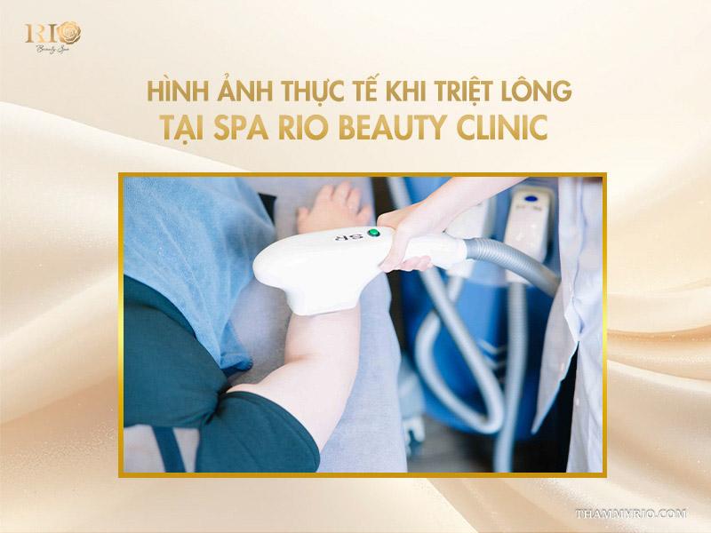 Lưu ý quan trọng khi áp dụng cách triệt lông tại nhà 6 Hình ảnh thực tế khi triệt lông tại spa Rio Beauty Clinic
