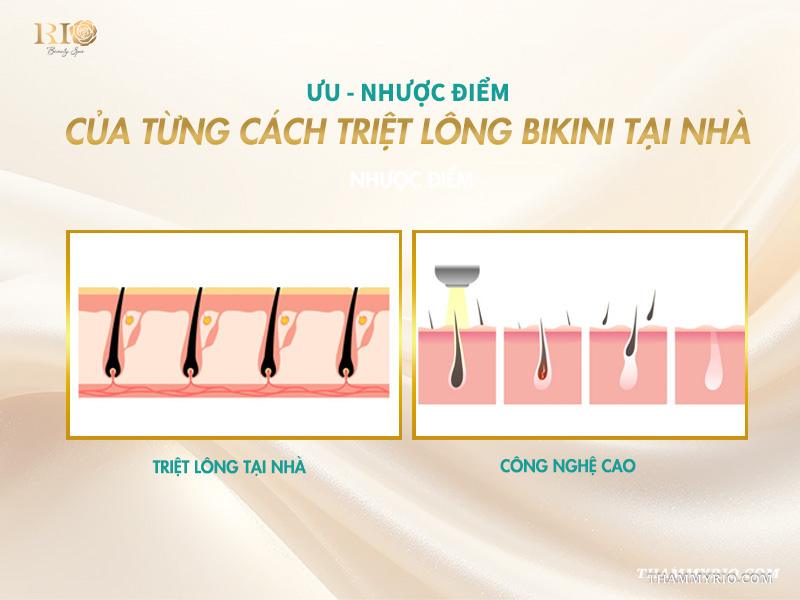 6 Cách triệt lông vùng kín tại nhà sạch mịn và an toàn 3 Ưu và nhược điểm của từng cách triệt lông bikini tại nhà
