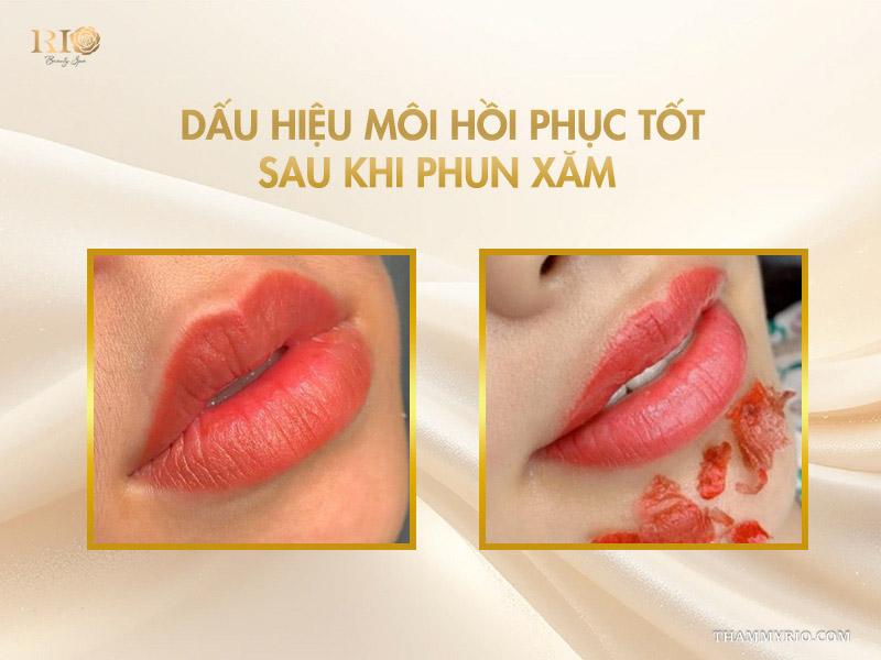 6 cách dưỡng môi sau phun giúp lên màu chuẩn, mềm mịn tự nhiên 8 Dấu hiệu môi hồi phục tốt sau khi phun xăm