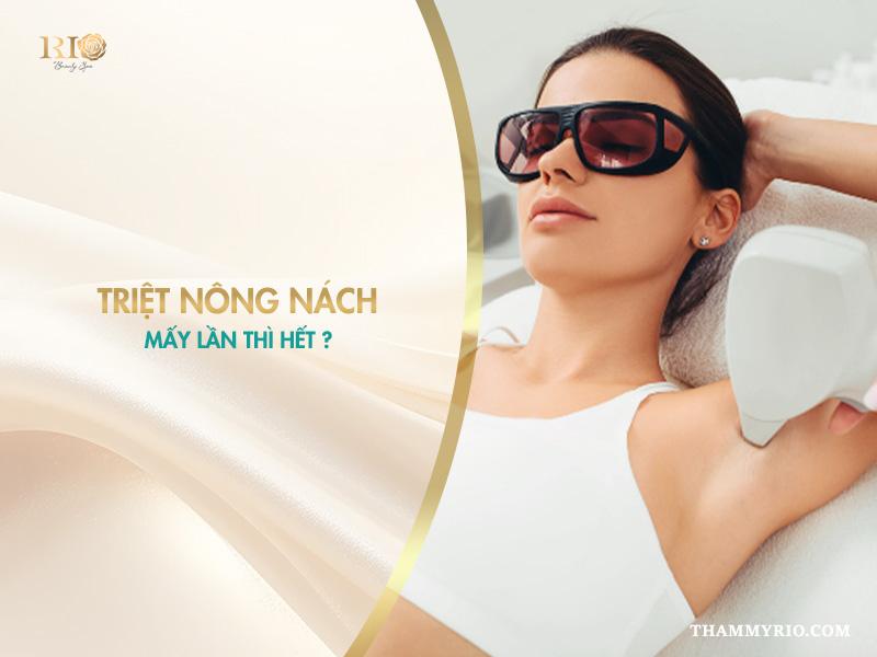 1 liệu trình triệt lông nách bao nhiêu buổi thì hết lông? 2 Triệt lông nách mấy lần thì hết?