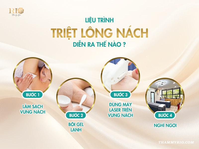 1 liệu trình triệt lông nách bao nhiêu buổi thì hết lông? 3 Liệu trình triệt lông nách diễn ra thế nào?
