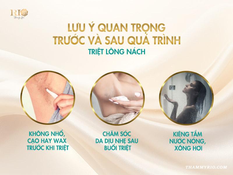 1 liệu trình triệt lông nách bao nhiêu buổi thì hết lông? 5 Lưu ý quan trọng trước và sau quá trình triệt lông nách