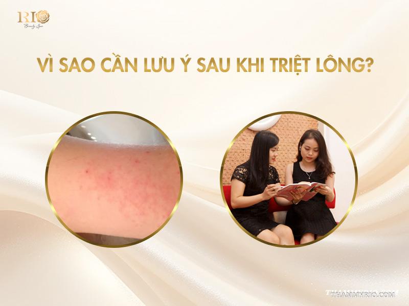 10 Lưu ý sau khi triệt lông giúp da láng mịn lâu dài 2 Vì sao cần lưu ý sau khi triệt lông?