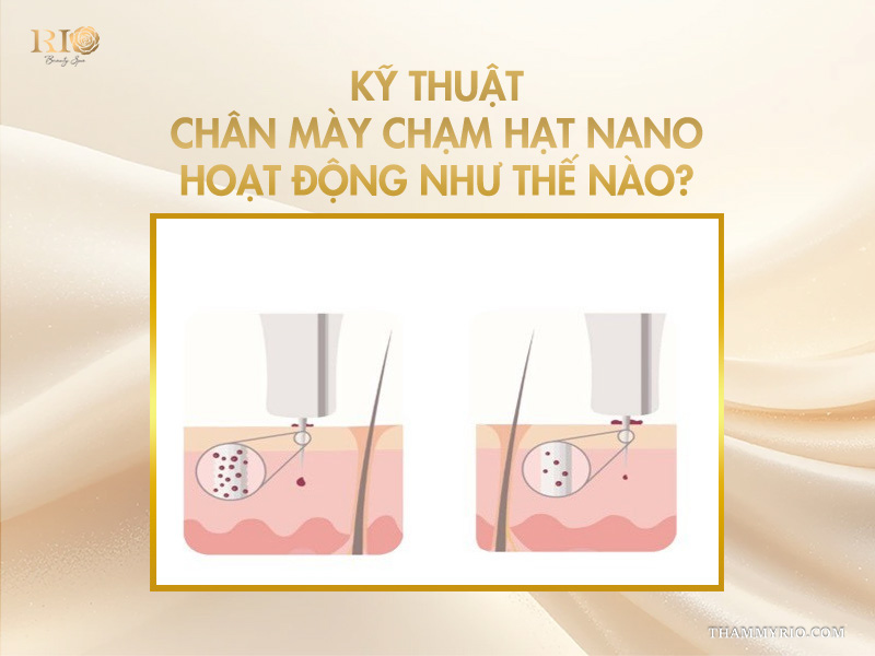 Công nghệ phun mày Nano: 7 lý do khiến 99% khách hàng tin chọn 4  Kỹ thuật chân mày chạm hạt Nano hoạt động như thế nào?