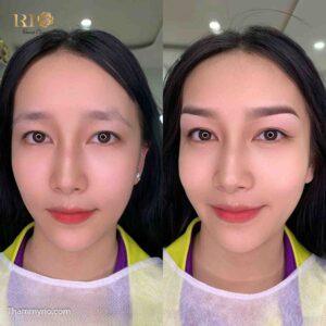 Sau khi phun xăm mí xong đôi mắt đẹp tự nhiên và không sưng, quá trình phun xăm mí mắt hoàn toàn không đau