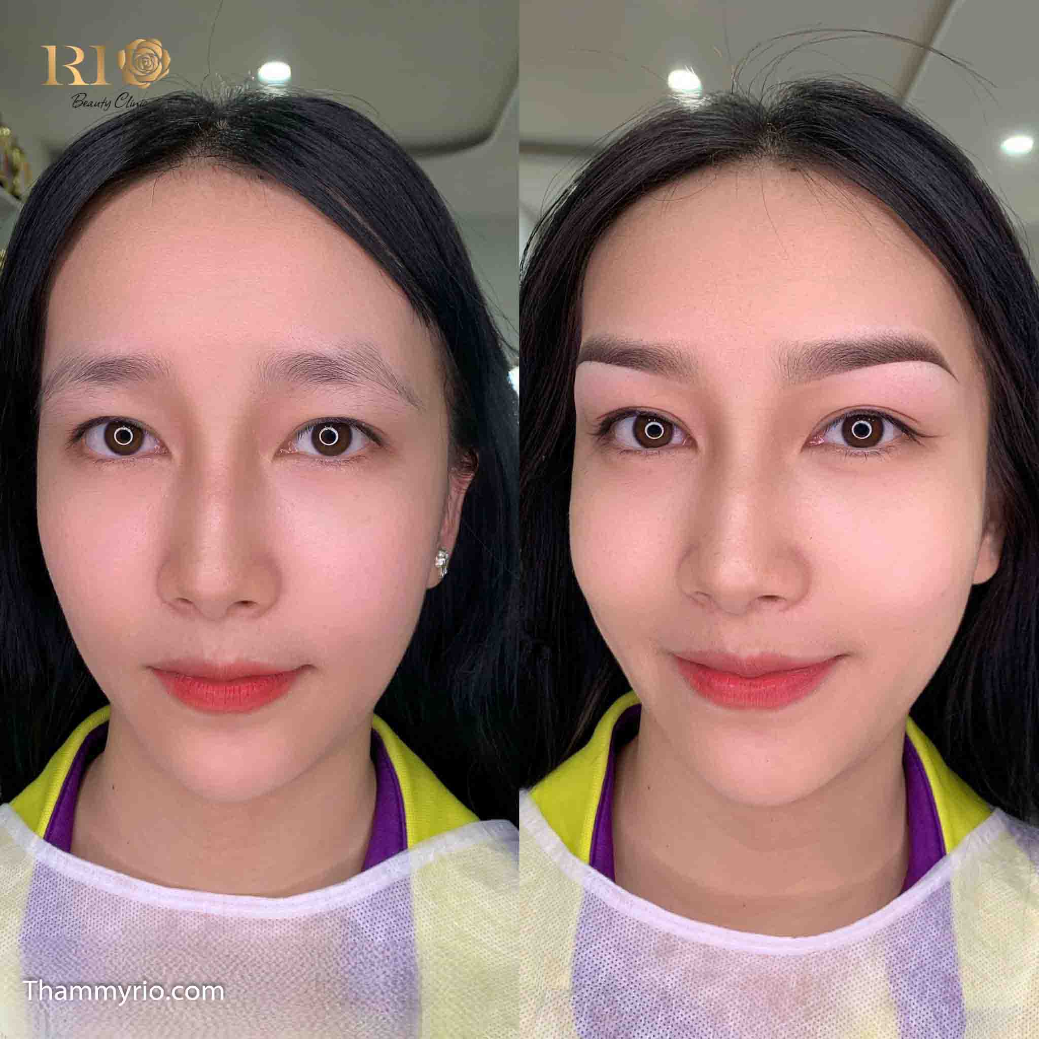 Phun xăm mí mắt – Thẩm Mỹ Rio Beauty clinic Sau khi phun xăm mí xong đôi mắt đẹp tự nhiên và không sưng, quá trình phun xăm mí mắt hoàn toàn không đau