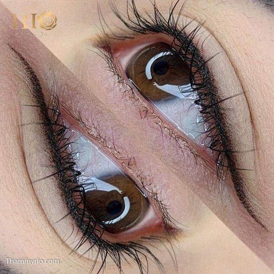 Eyelid spraying 33 phun mi mat 099