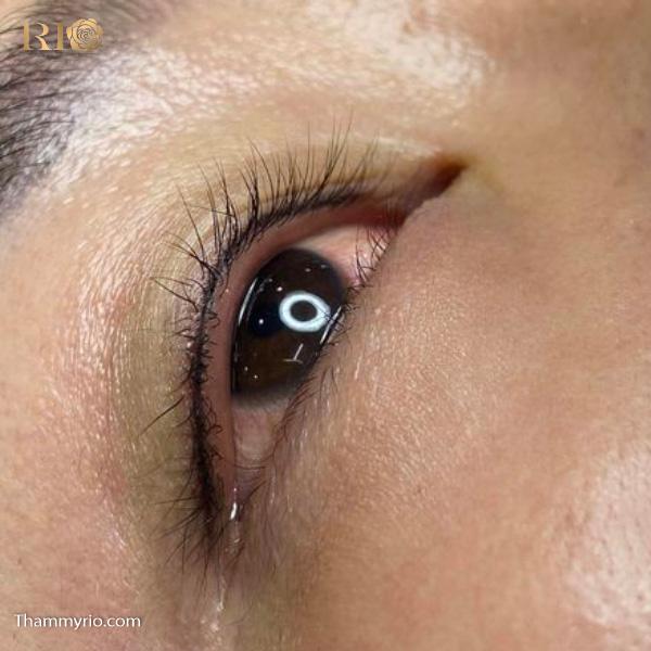 Eyelid spraying 28 phun mi mat 14