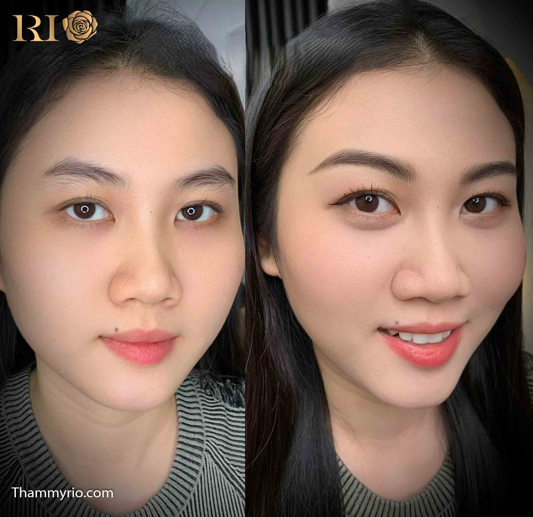 Eyelid spraying 32 phun mi mat 29