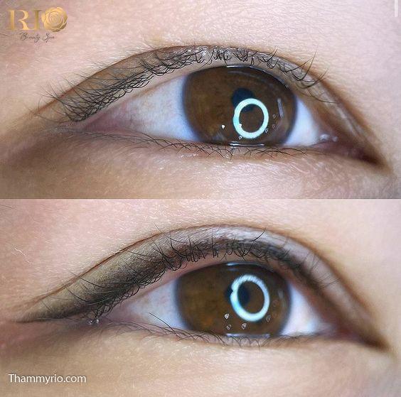 Eyelid spraying 9 phun mi mat 58