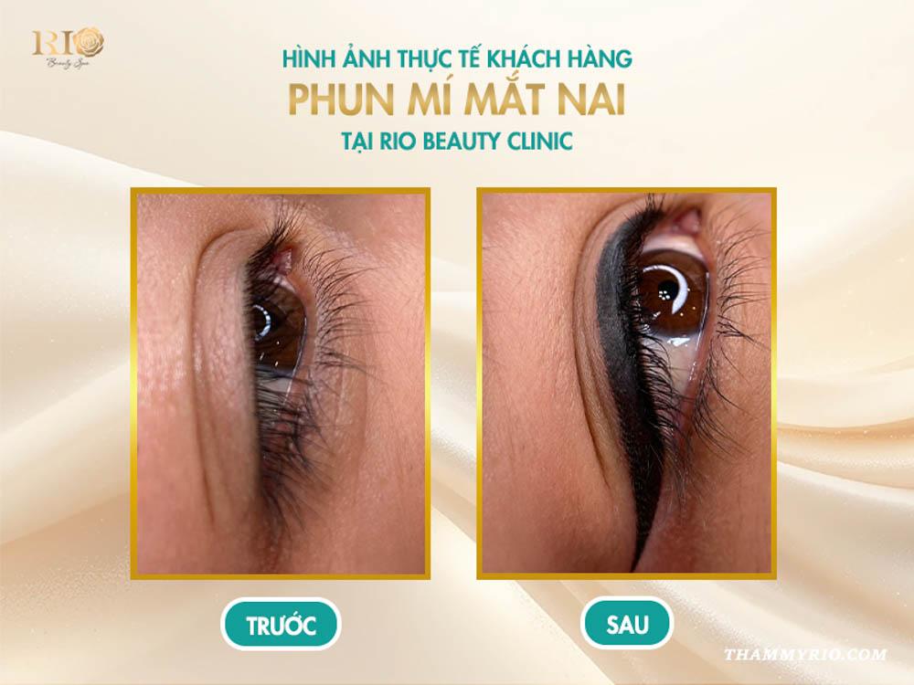 Phun mí mắt nai là gì? 8 sự thật khiến ai cũng mê mẩn 6 Hình ảnh thực tế khách hàng sau khi phun mí mắt nai tại Rio Beauty Clinic