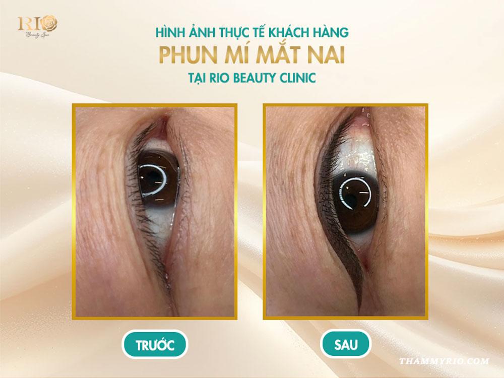 Phun mí mắt nai là gì? 8 sự thật khiến ai cũng mê mẩn 7 Hình ảnh thực tế khách hàng sau khi phun mí mắt nai tại Rio Beauty Clinic phun mí mắt nai tại Rio Beauty Clinic
