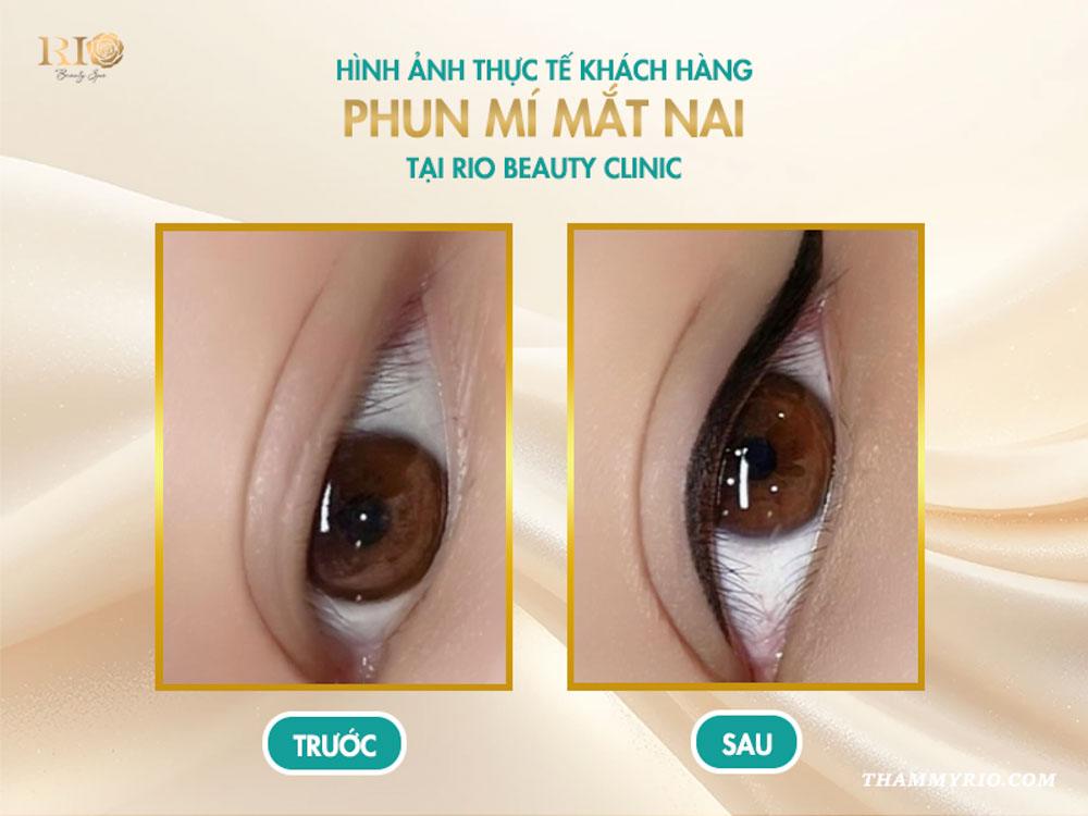 Phun mí mắt nai là gì? 8 sự thật khiến ai cũng mê mẩn 8 Hình ảnh thực tế khách hàng sau khi phun mí mắt nai tại Rio Beauty Clinic