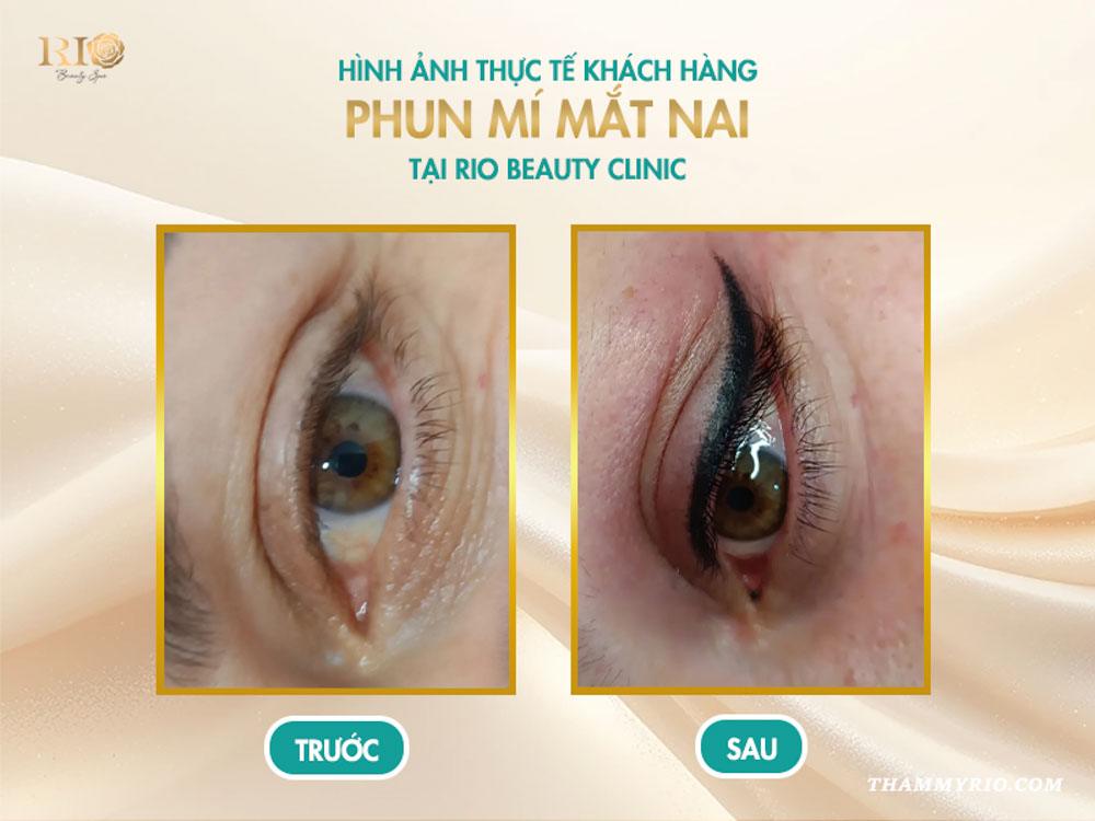 Phun mí mắt nai là gì? 8 sự thật khiến ai cũng mê mẩn 9 Hình ảnh thực tế khách hàng sau khi phun mí mắt nai tại Rio Beauty Clinic