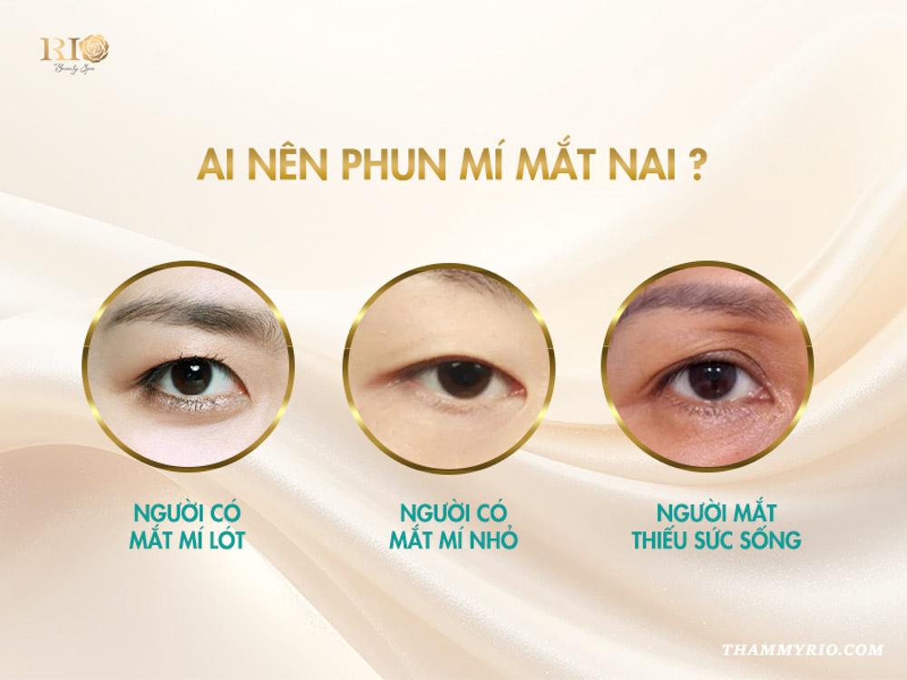 Phun mí mắt nai là gì? 8 sự thật khiến ai cũng mê mẩn 4 Ai nên phun mí mắt nai?