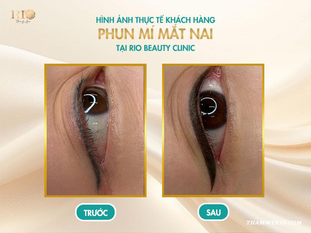 Phun mí mắt nai là gì? 8 sự thật khiến ai cũng mê mẩn 5 Hình ảnh thực tế khách hàng sau khi phun mí mắt nai tại Rio Beauty Clinic