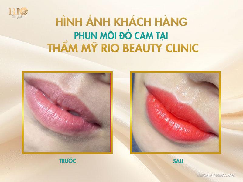 Phun môi màu đỏ cam: 10 điều cần biết để lên tone chuẩn 11 Hình ảnh khách hàng phun môi đỏ cam tại Thẩm mỹ Rio Beauty Clinic