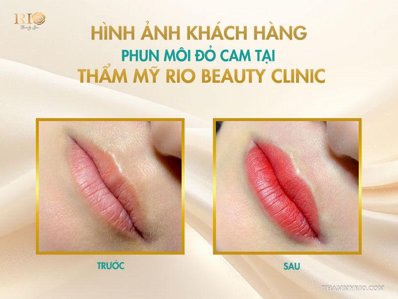 Phun môi màu đỏ cam: 10 điều cần biết để lên tone chuẩn 7 Hình ảnh khách hàng phun môi đỏ cam tại Thẩm mỹ Rio Beauty Clinic