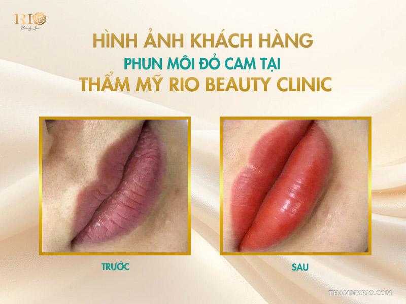 Phun môi màu đỏ cam: 10 điều cần biết để lên tone chuẩn 8 Hình ảnh khách hàng phun môi đỏ cam tại Thẩm mỹ Rio Beauty Clinic