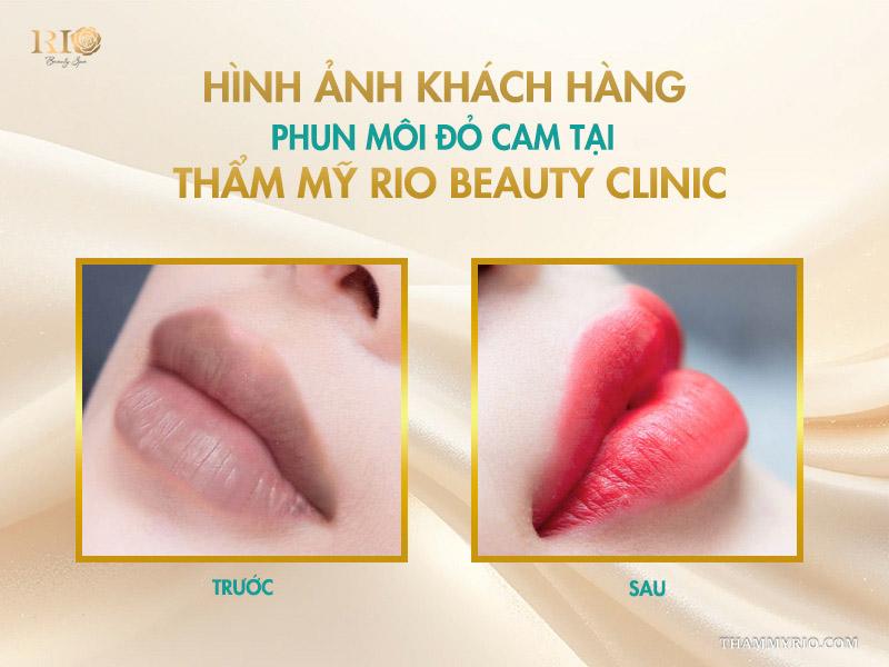 Phun môi màu đỏ cam: 10 điều cần biết để lên tone chuẩn 9 Hình ảnh khách hàng phun môi đỏ cam tại Thẩm mỹ Rio Beauty Clinic