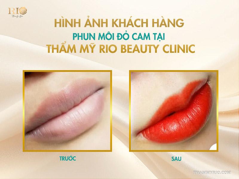 Phun môi màu đỏ cam: 10 điều cần biết để lên tone chuẩn 10 Hình ảnh khách hàng phun môi đỏ cam tại Thẩm mỹ Rio Beauty Clinic