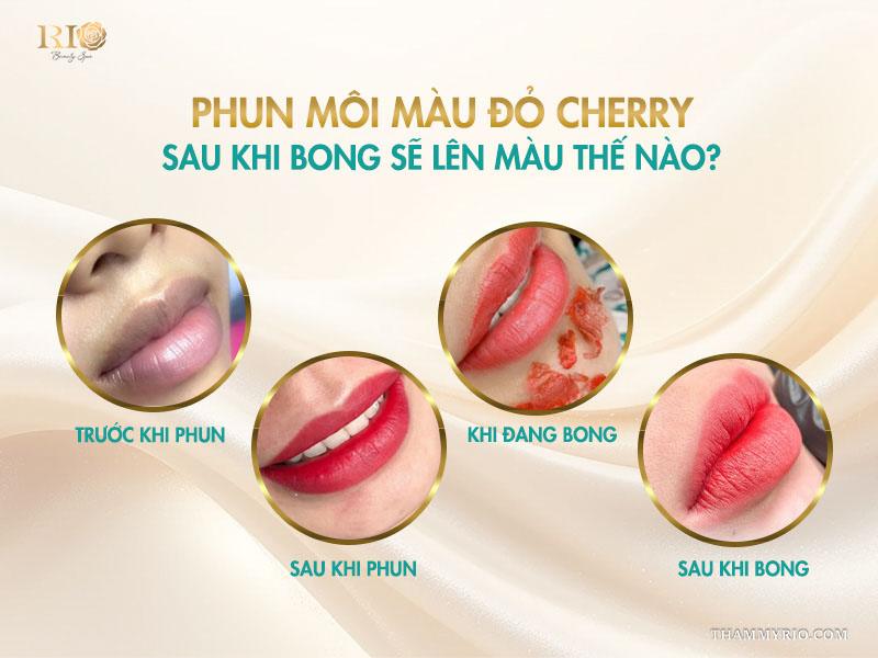 Phun môi màu đỏ cherry: Tông màu “nịnh da” được ưa chuộng nhất 8 Phun môi màu đỏ cherry sau khi bong sẽ lên màu thế nào?