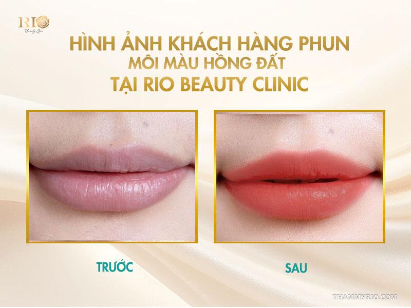 Phun môi màu hồng đất là gì? Bảng màu và quy trình chuẩn 2025 11 Hình ảnh khách hàng phun môi màu hồng đất tại Rio Beauty Clinic